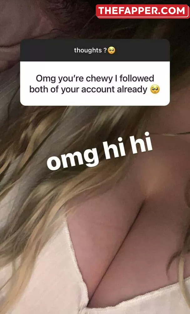 Chewys.melons  Onlyfans Leaked Nude Image #lVwAbQcbRE