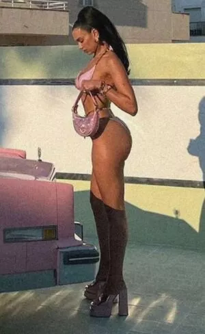 Dua Lipa Onlyfans Leaked Nude Image #eriSYltj5J