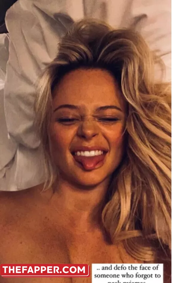 Emily Atack  Onlyfans Leaked Nude Image #4CfCZFm2ae