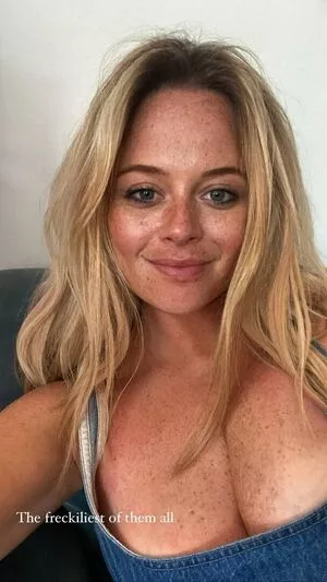 Emily Atack Onlyfans Leaked Nude Image #APmEwHjV7C