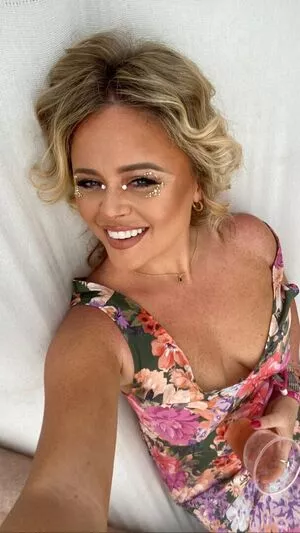 Emily Atack Onlyfans Leaked Nude Image #NYy596l9Pp