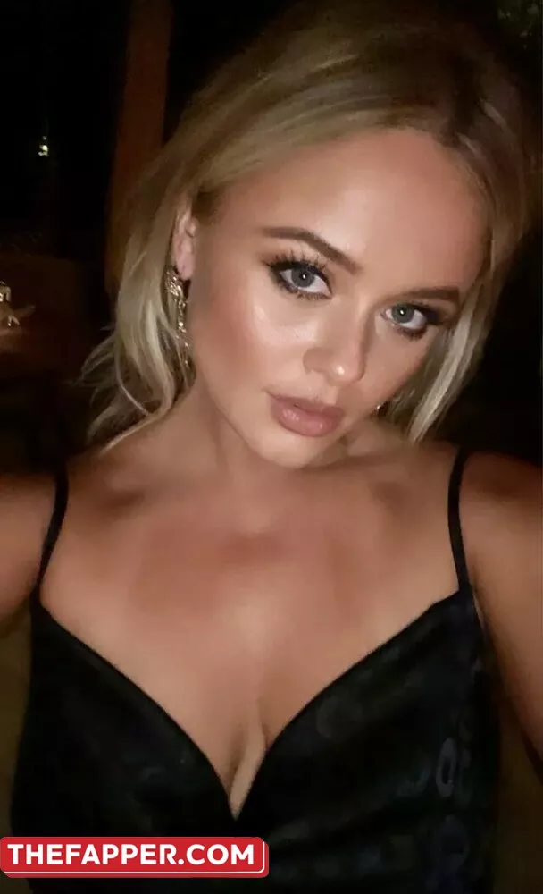 Emily Atack  Onlyfans Leaked Nude Image #hPnAzkHifX