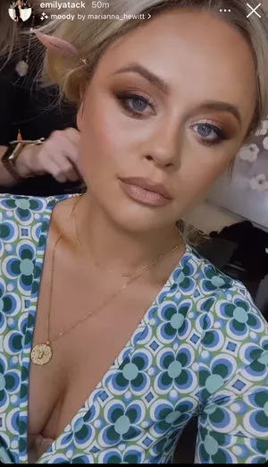 Emily Atack Onlyfans Leaked Nude Image #jHyO3CqxT6