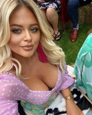 Emily Atack Onlyfans Leaked Nude Image #qJsudKbjEl