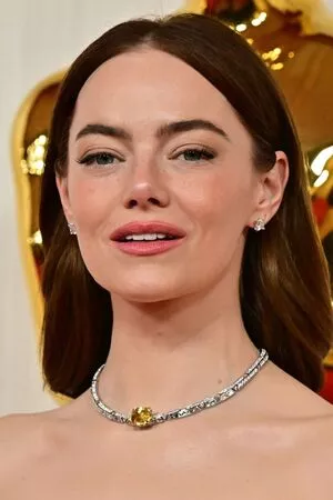 Emma Stone Onlyfans Leaked Nude Image #XG0tNTo9sJ