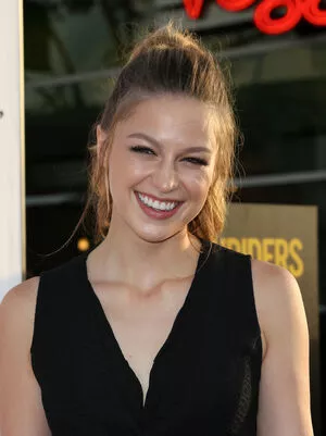 Melissa Benoist Onlyfans Leaked Nude Image #czF9TBWBI9