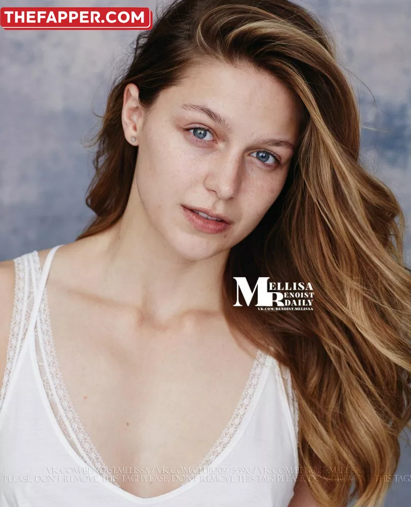 Melissa Benoist  Onlyfans Leaked Nude Image #nLWmR4XJB2