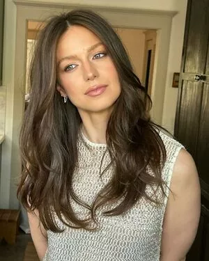 Melissa Benoist Onlyfans Leaked Nude Image #tIRHgxp1O3